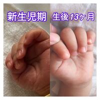 赤ちゃんの爪の形について 生後７ヶ月の娘がいます その娘の手の爪の形が Yahoo 知恵袋