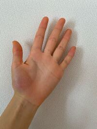 足の裏や 手のひら 肌が全体的に黄色いです みかんは食べてない Yahoo 知恵袋