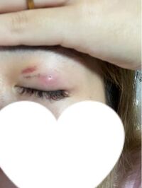 携帯電話を枕元に置いて寝るのは電磁波により脳腫瘍リスクが高まる かもしれな Yahoo 知恵袋