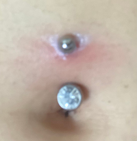 へそピについて この白いのはなんですか いつか取れますか Yahoo 知恵袋