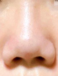 優性遺伝は 劣性遺伝 主人がいわゆる豚鼻です 鼻が短く 鼻の Yahoo 知恵袋