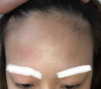 18歳女です おでこが広すぎて 髪も細く軽く少ないので悩んでます ハ Yahoo Beauty