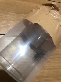 低酸素脳症について教えてもらいたいのですが どの様な病気ですか ま Yahoo 知恵袋