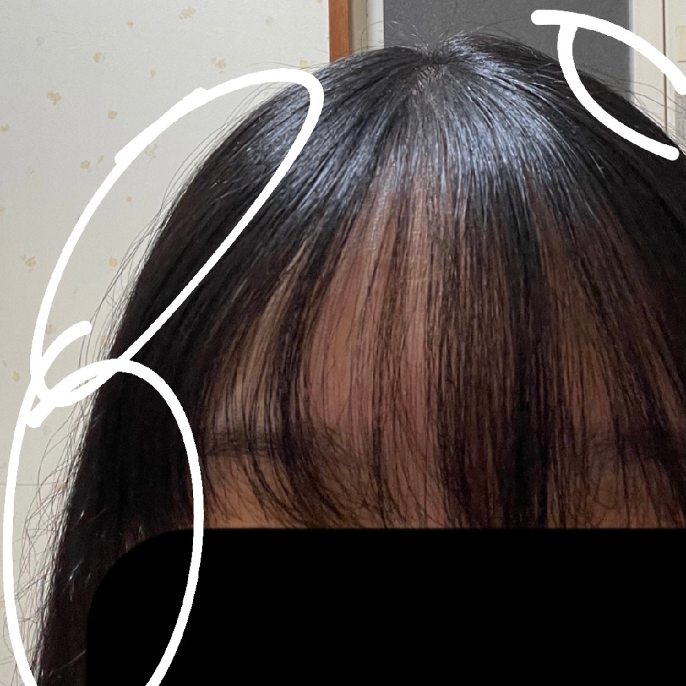 枝毛が凄くて悩んでます。髪の毛が縮れて陰毛みたいになってます