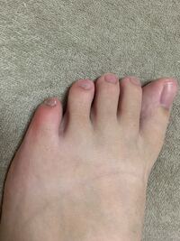 スニーカーを履いてて小指が痛くなります右足だけどうしてですか どうし Yahoo 知恵袋