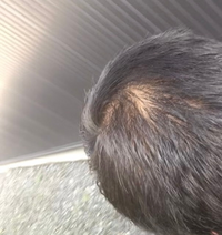 床屋で全体的に短くしてくれと言ったら つむじあたりがやたら地肌が目立ちま Yahoo 知恵袋