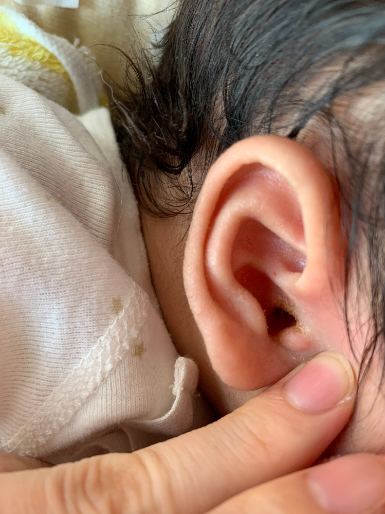 耳の病気 解決済みの質問 Yahoo 知恵袋