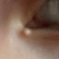 写真があるので注意です 目元に白いできもののようなも Yahoo 知恵袋