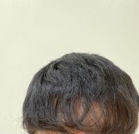 男子高校生です 自分はくせ毛なのですが そのせいで前髪が透 Yahoo 知恵袋