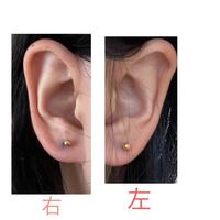 ピアスが左右対称ではない ピアスを開けて４か月ほどた Yahoo 知恵袋