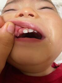 一歳２ヶ月の息子です 昨日の歯磨きまで気づかなかったので Yahoo 知恵袋