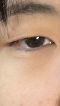 眼瞼下垂ですか ただの一重瞼でしょうか 精一杯目を開けた Yahoo 知恵袋