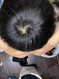 これってつむじ薄いですか 高校2年男 髪型 マッ Yahoo 知恵袋
