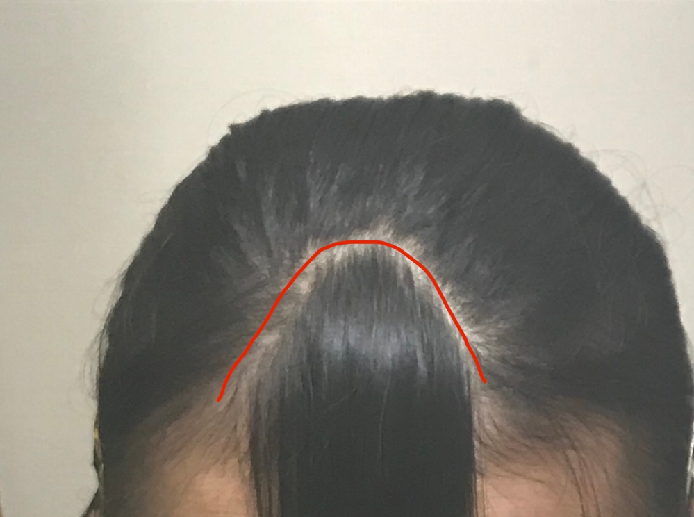 中学生です 前髪の三角形の作り方が分かりません 美容院は行った Yahoo 知恵袋