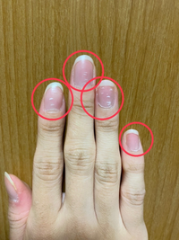 爪の白い点が消えません 手相占いなんかだと 幸運の星とか言われている Yahoo 知恵袋