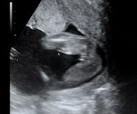 妊娠週です 今日先生に90 女の子だねと言われました 男の Yahoo 知恵袋