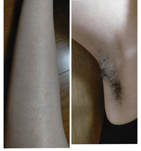 毛深い陰毛画像　剛毛画像　女性 