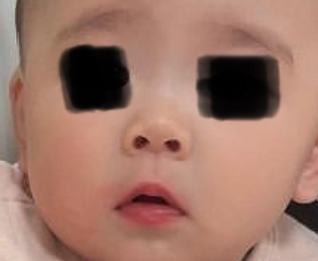 赤ちゃんのころ鼻筋がへこんでいるのは成長過程で変わりますか 少しは通った Yahoo 知恵袋