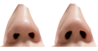 鼻の穴がコンプレックスです。
下から見ると写真１枚目のような形なのですが、2枚目のような形が理想です。(2枚目は加工です) 整形などは考えていませんが、少しでもこの形に近くなるマッサージなど方法ありませんか？