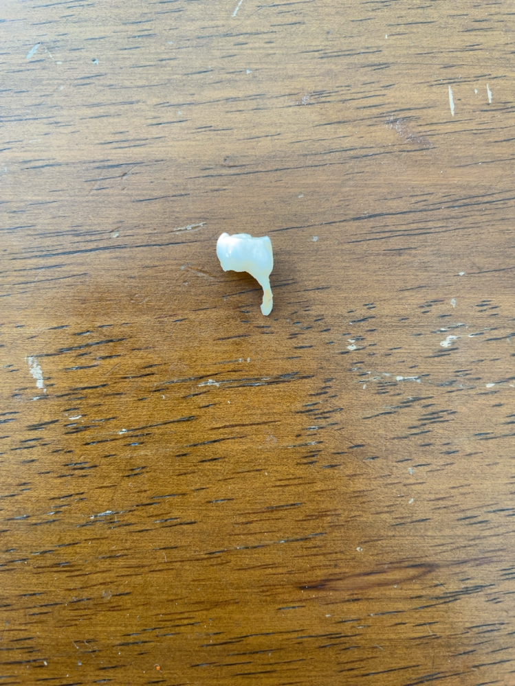 自分の乳歯が保存されてたので見ていたのですが、形がおかしいのが1つありました。 これはどういう歯