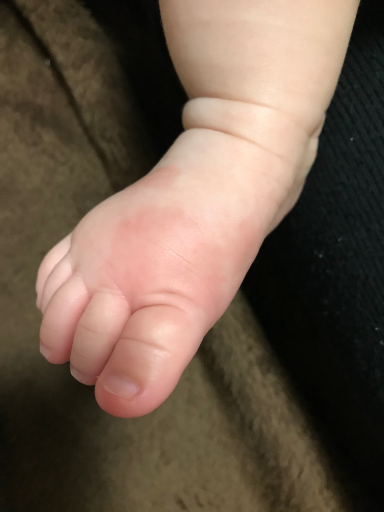 子どもの病気とトラブル 解決済みの質問 Yahoo 知恵袋