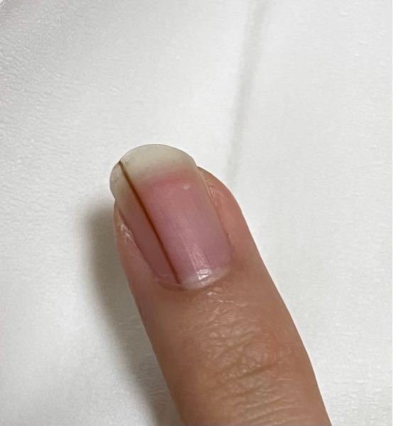 爪にあるこの茶色の線ってなんですか？