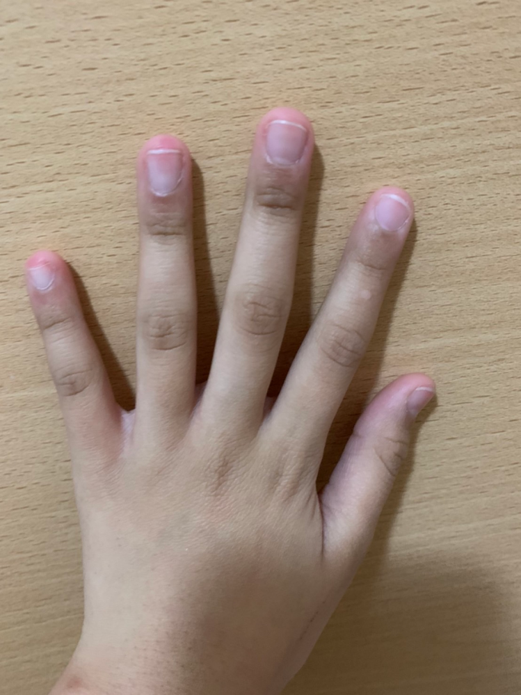 女子中学生です。 私の指の爪は横幅が長く、四角い形で小さいです。 縦長で綺麗な爪になるにはどうしたら良いでしょうか？？