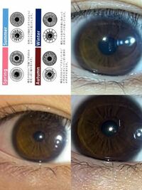 眼球注意！！ ずっとパーソナルカラー診断をしてみたい！
とは思っているのですが、離島に住んでおり
コロナ禍のため、なかなか島外に出れず、
行けずじまいです、、(;_;)
この写真はわたしの目なのですが、
パーソナルカラー診断をするとなると、
どの模様に当てはまるでしょうか？
イエベ秋かな？とは思っているのですが、
どうでしょうか？zozoグラスでは、
ブルベ夏とイエべ秋になりました、、！
わ...