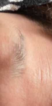 抜き過ぎて生えなくなった眉毛を生やしたいです 中高で眉毛を抜き Yahoo 知恵袋