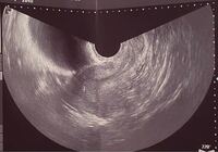 今日産婦人科に行って検査したところ妊娠5週目でした です Yahoo 知恵袋