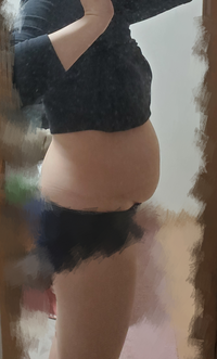 画像有 お目汚し申し訳ありません 画像の通り 異様にお腹が出ています Yahoo 知恵袋