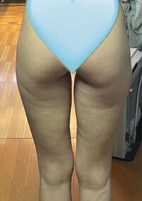 筋トレめちゃめちゃやってるのに 脚のセルライトがひどいです Yahoo 知恵袋