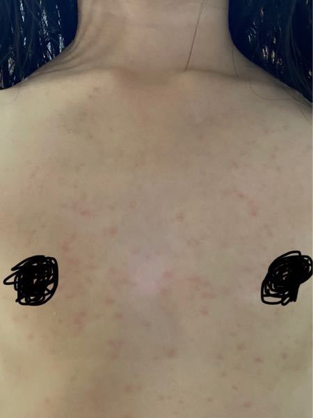 子どもの病気とトラブル 解決済みの質問 Yahoo 知恵袋