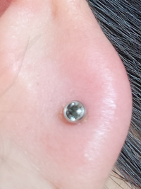 緊急 ピアスを開けて1週間が経ちました 昨日の夜から腫れてきてしまいま Yahoo 知恵袋