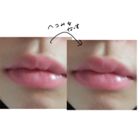 唇 ヒアルロン酸について

画像の通り上唇の真ん中が凹んでいて(左)コンプレックスなのですが、凹みを治す(右)には幾らぐらいかかるのでしょうか。

大凡の値段で大丈夫です。 