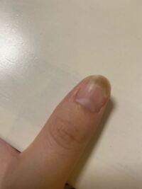 ジェルネイルが原因で グリーンネイルというものに 初めてな Yahoo 知恵袋