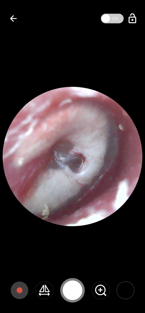 耳の病気 解決済みの質問 Yahoo 知恵袋