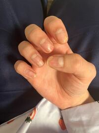 質問です 爪がすごい掛けててボロボロでも 長さだしネイルって出 Yahoo 知恵袋