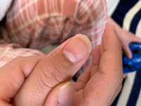 10歳の子供の爪に縦線がでてることに最近きづきました 爪をきるときに見て Yahoo 知恵袋