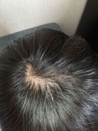 10代男です 前までは 髪が硬くちくちくしていました しか Yahoo 知恵袋
