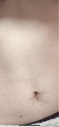 最愛の彼氏がこんな腹毛でしても愛してくれますか Yahoo 知恵袋