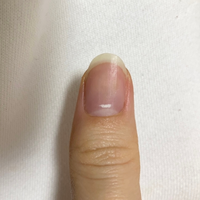 ジェルネイルが二週間でカビてしまいましたサロンでジェルネイルをやってもら Yahoo 知恵袋