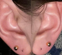ピアスの二つ目を開けました。位置にに左右差があり、個人的には