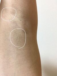 女子高生　脇 女子高校生なのですが、脇の毛とあそこの毛について。 - 2.3本だけめっ... - Yahoo!知恵袋