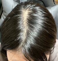 髪の毛つむじ が真ん中ではなく横にあります そのため前髪 Yahoo 知恵袋