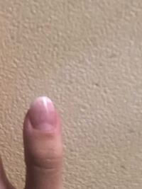 至急お願いします 私は爪をむしる癖があって男爪深爪なのですが Youtu Yahoo 知恵袋