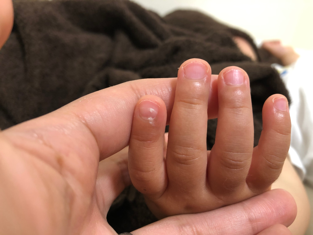 子どもの病気とトラブル 解決済みの質問 Yahoo 知恵袋