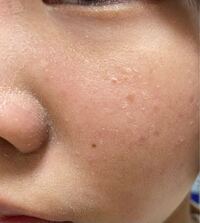 至急 先日 ティルティルのクッションファンデ 赤 を初めて使ってみた結 Yahoo 知恵袋