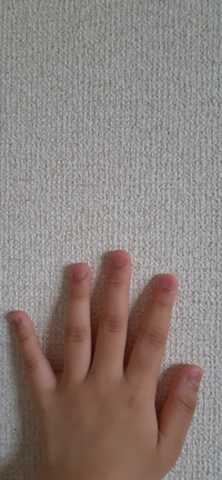 綺麗な手になりたいです 私は女子中学生なのですが 手が醜いんで Yahoo 知恵袋