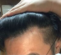 ハゲてますか 剃り込みいれた ちょっと兆候が出てかたね Yahoo 知恵袋